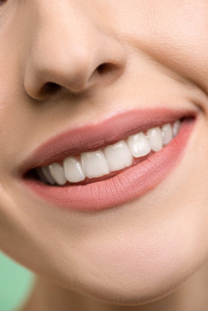 Teeth Whitening Services Largo, Florida