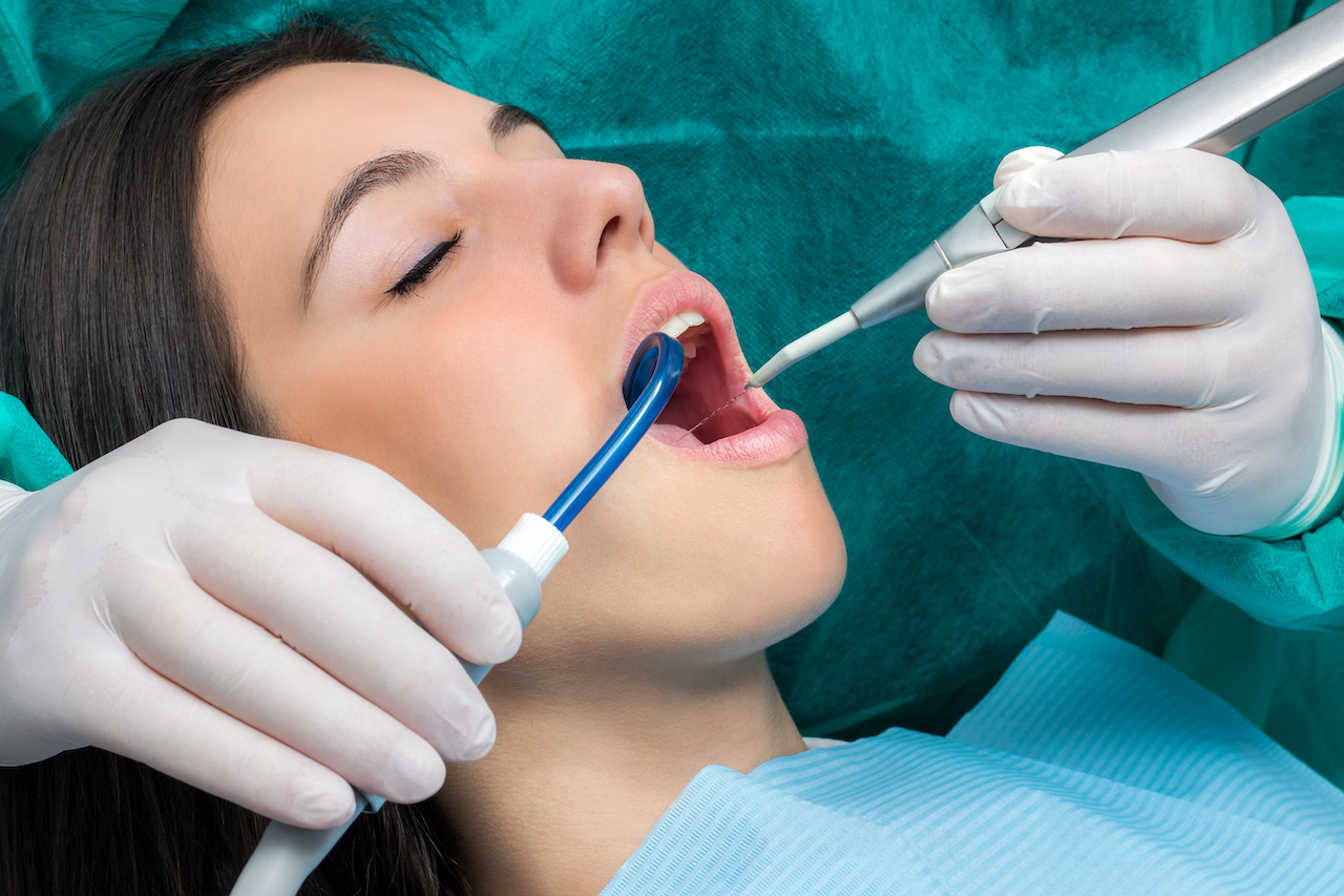 Prophylaxis dental cleaning in Largo, FL